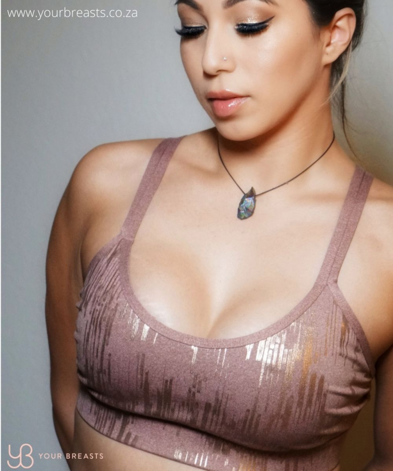 Breast Augmentation in Cape Town