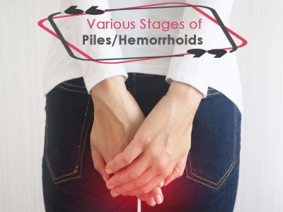 Stages of Piles
