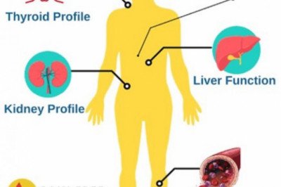 Redcliffe Labs -  Full Body Checkup In Pune