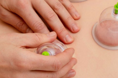 hijama