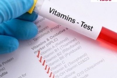 Redcliffe Labs - Vitamin D Test Price in Delhi