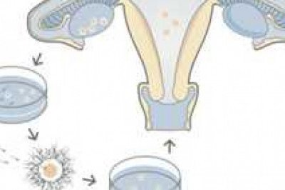 Global In Vitro Fertilization (IVF) Market Report by size, comprehensive analysis, growth rate, general attractiveness, and forecast 2028