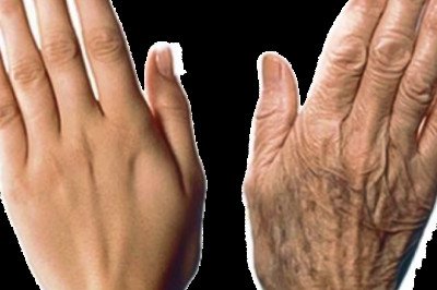 Hand Rejuvenation in Dubai - Prof Dr. Robert Hierner