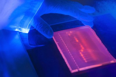 Electrophoresis Market Growth, Trends, Size, Share, Demand And Top Growing Companies 2025