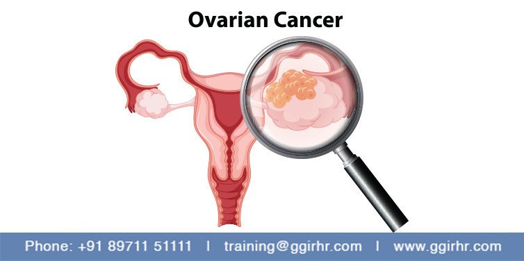 Ovarian cancer and infertility | Linkgeanie.com