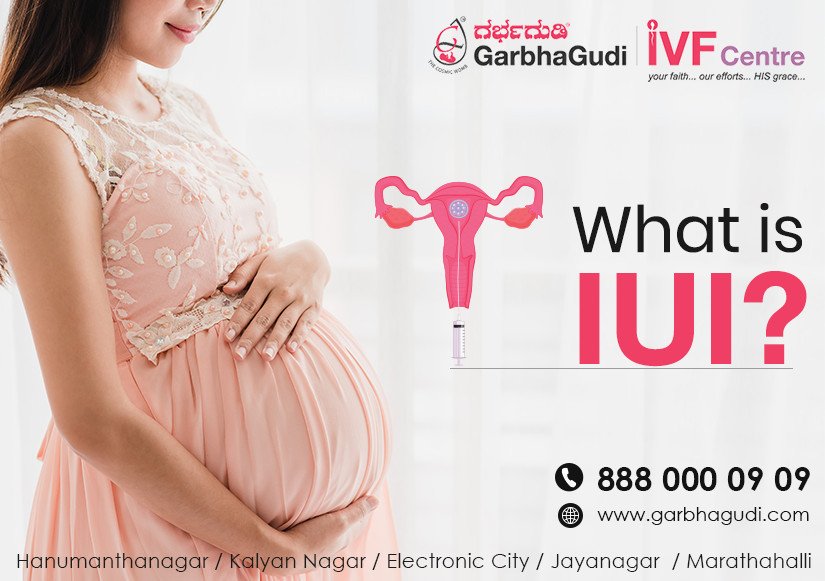 What is IUI? When should one do it? Best IVF Centre