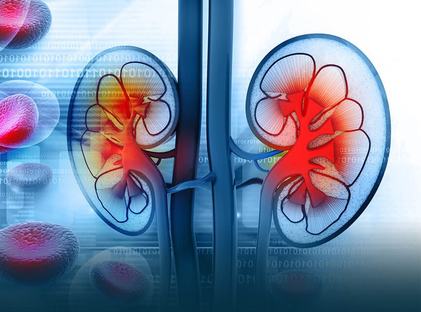 kidney disease treatment | kidney stones treatment | kidney failure treatment