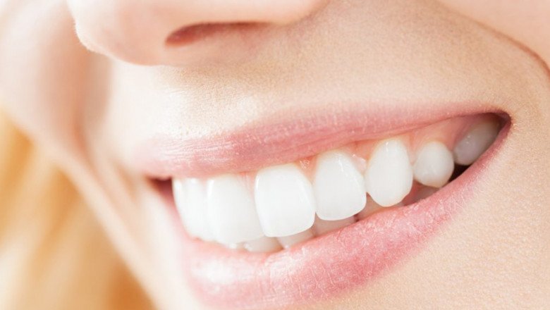 Same Day Cerec Dental Crowns in Pitt Meadows and Maple Ridge
