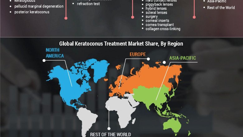Keratoconus Treatment Market Trends, size, growth outlook, research insights and latest trends dynamics by 2027