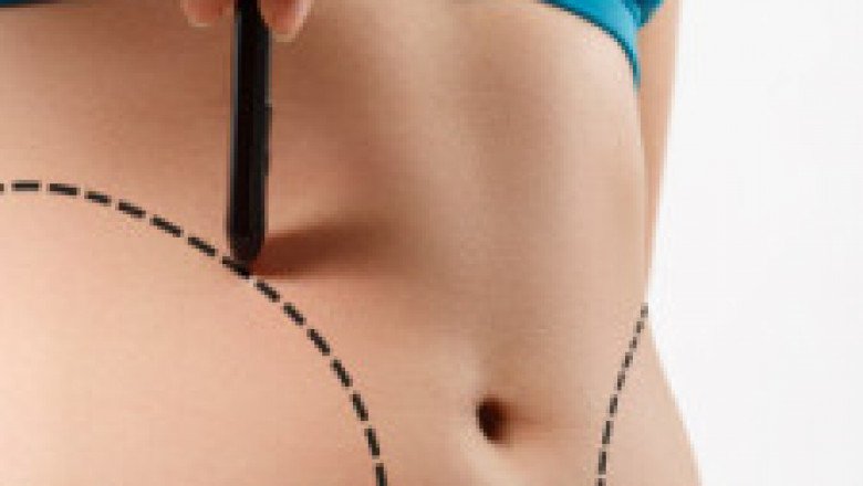 Cosmetic Surgery In Pune | Cosmetic/Plastic Surgery Clinic In Pune - Karishma Cosmetic