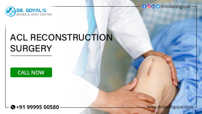 Best ACL Reconstruction Surgeon In Delhi