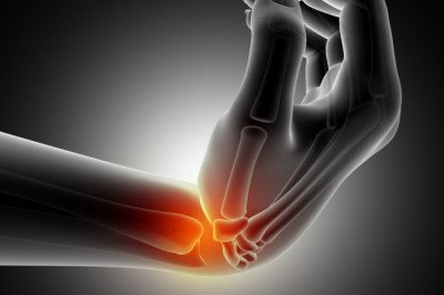Akseer Salajeet | Arthritis Treatment