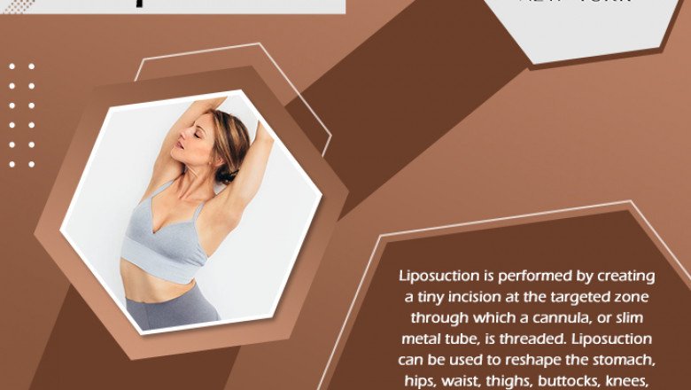 Slim Down And Shape Up: Get Rid Of Excess Fat With Liposuction
