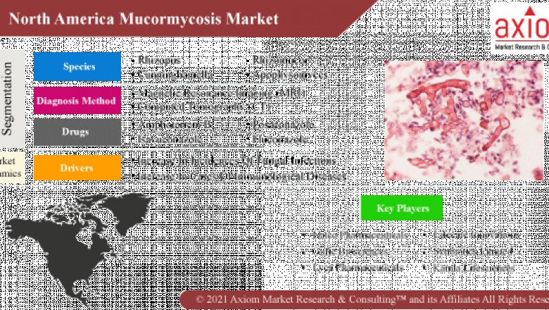 North America Mucormycosis Market: Key Players, Share, And Forecast Report To 2028