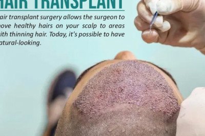 About UK HairTransplant