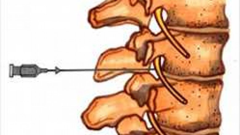 Global Pain Management Therapeutics Market Report by size, cagr analysis, growth factors, top trends, and forecast 2028