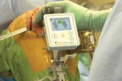 Global Orthopedic Navigation Systems Market Report by size, future strategies, changing dynamics, and trends forecast 2028