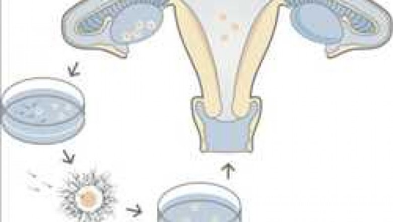 Global In Vitro Fertilization (IVF) Market Report by size, comprehensive analysis, growth rate, general attractiveness, and forecast 2028