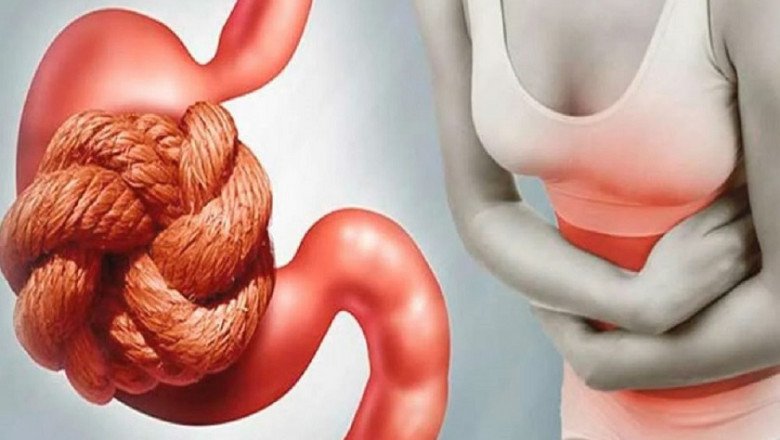For Constipation Treatment, Lifestyle And Diet Changes Must Be Made To Increase Stool Passage Speed
