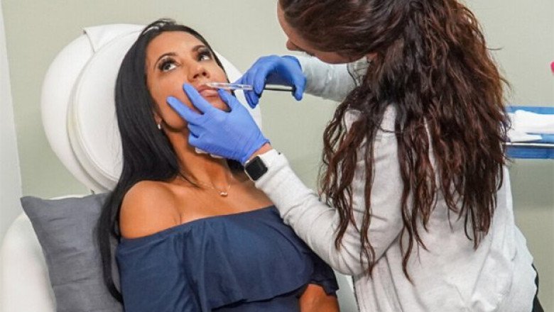 LIP FILLERS Treatment in Miami Fl, By Nuceria Health