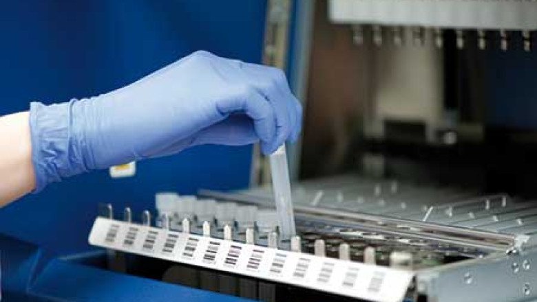 Global Nucleic Acid Testing Market Country Wise Analysis