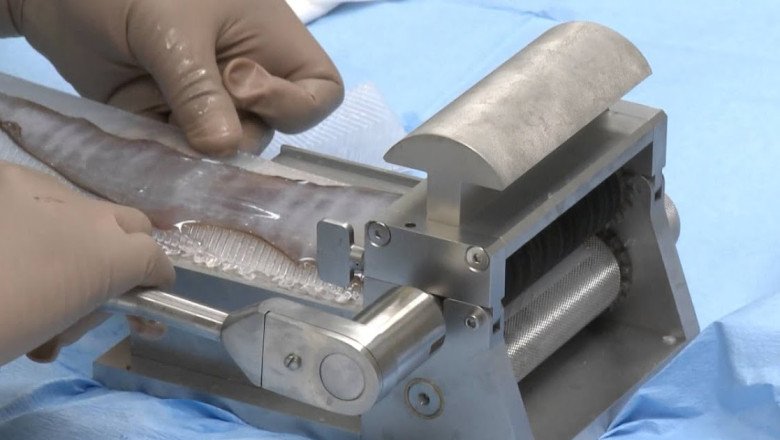 Global Dermatome Device Market Dynamics