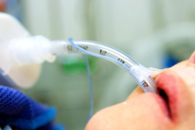 Managing Complications Associated with Endotracheal Tubes: Strategies for Prevention and Treatment