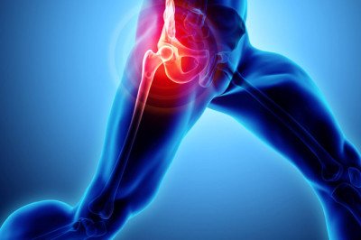 Treating Avascular Necrosis: Medications, Surgery, and Rehabilitation