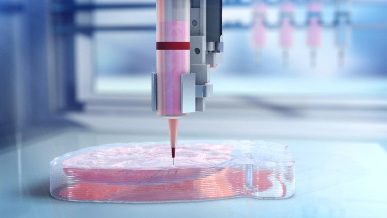 Using 3D Bioprinting To Create Patient-Specific Implants And Prosthetics